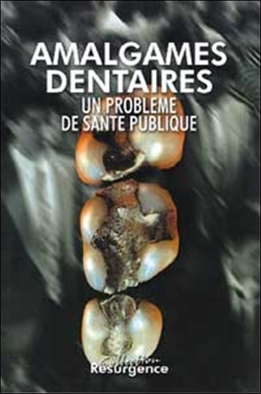 AMALGAMES DENTAIRES