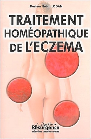 TRAITEMENT HOMEOPATHIQUE DE L'ECZEMA