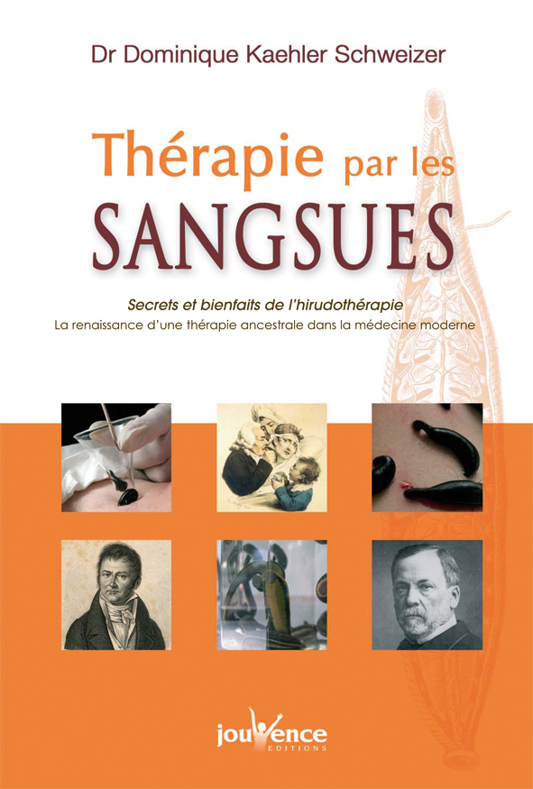 n°248 Thérapie par les sangsues