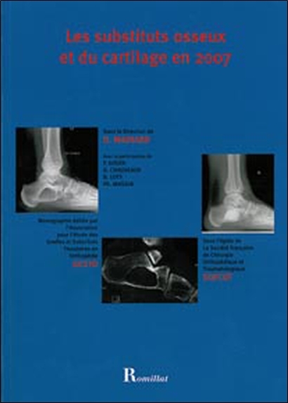 Substituts osseux et du cartilage en 2007