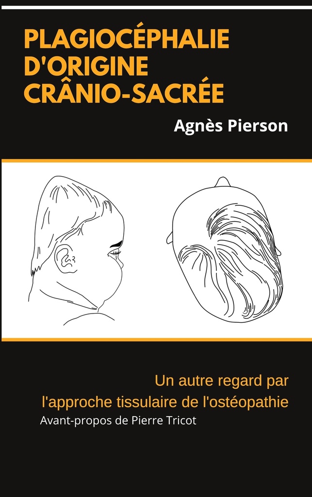plagiocéphalie d'origine crânio-sacrée
